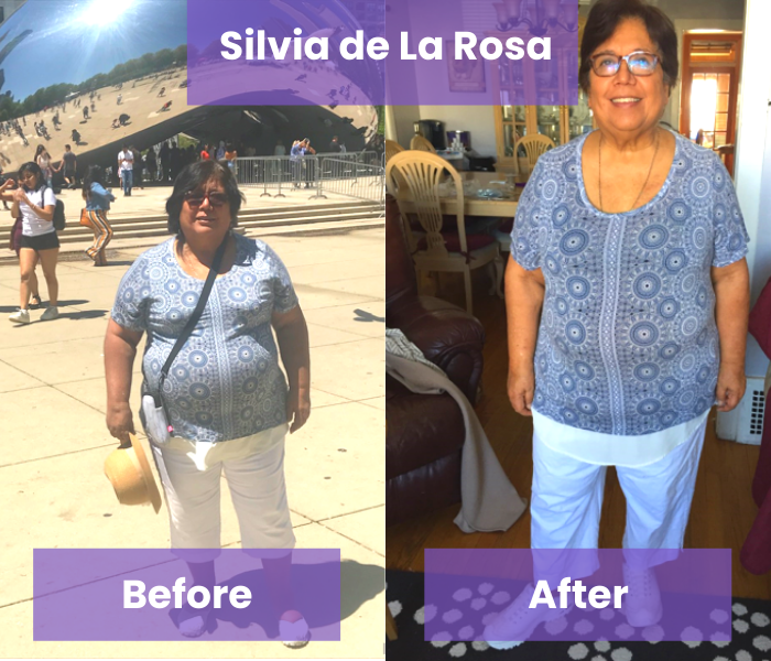 Patient Silvia de la Rosa before and after.